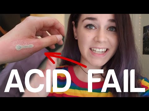 USING ACID TO REMOVE TATTOO: FAIL