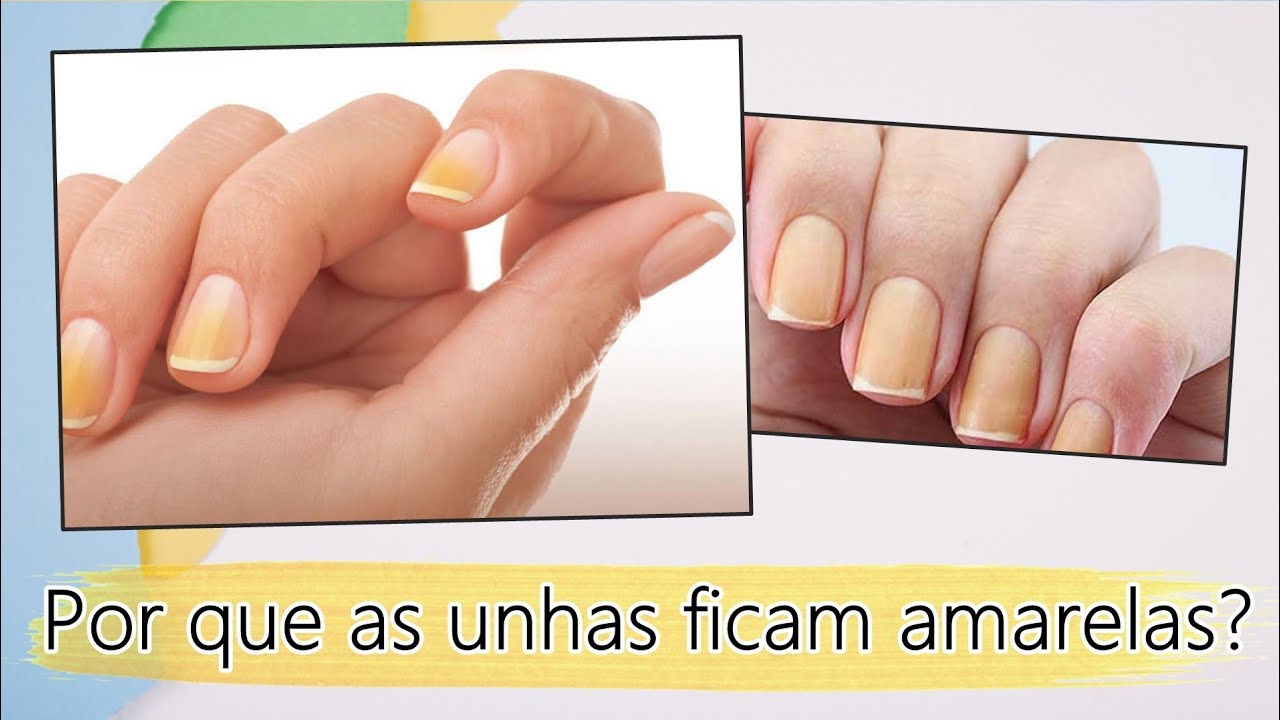 Por que as unhas ficam amarelas? - Isabela Martin - YouTube