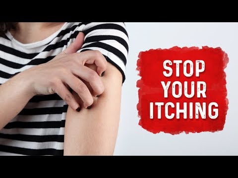 What Causes Hives and Itchiness