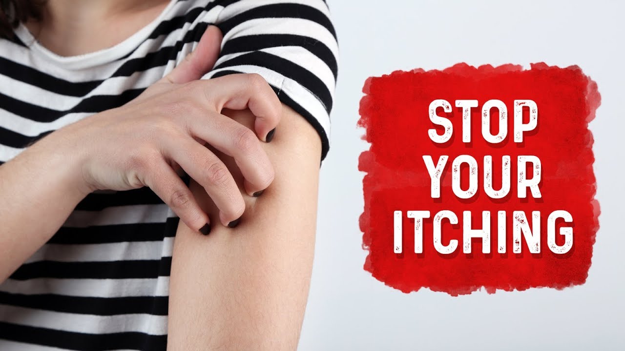 What Causes Hives and Itchiness - Dr. Berg