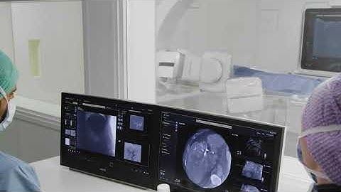 Simplifying and advancing 3D imaging with SmartCT in trans arterial chemo embolization