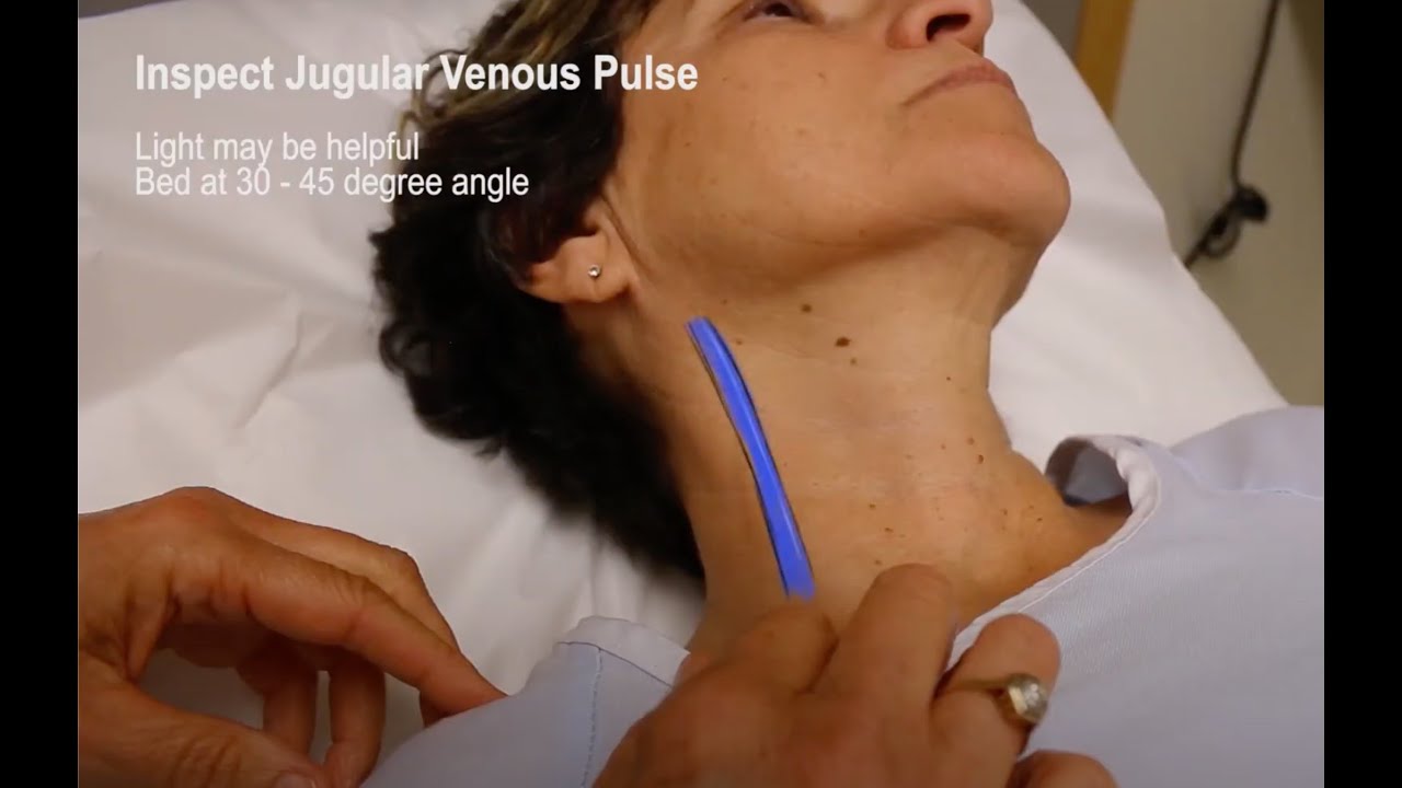 Основной медицинский экзамен (обзор для студентов-медиков)