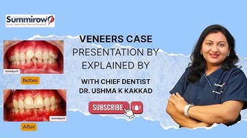 Veneers Case Presentation by Dr. Ushma k  Kakkad | Smile Transformation Explained