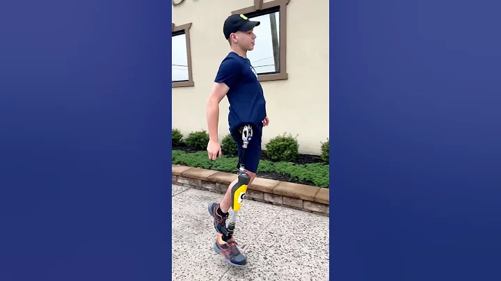 Hemipelvectomy Amputee Running with Prosthetic Leg | Kristofer