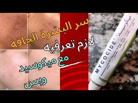 البشرة تاعك حساسة وجربتي جميع المنتجات وملقيتيش الحل ارواحي ختي 15 الف ونتي فريتيها مع ميكوسيد