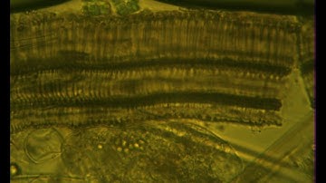 MT 43 mp4 Save the Water Microorganism Microscope Video