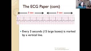 NUR265 UNIT 2 & 3 ECG DYSRHYTHMIAS