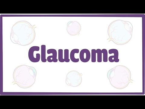 Glaucoma (tăng nhãn áp)