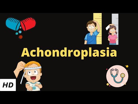 Achondroplasia، وجوہات، علامات اور علامات، تشخیص اور علاج.