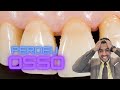 PERDA ÓSSEA NA BOCA E AO REDOR DOS DENTES!