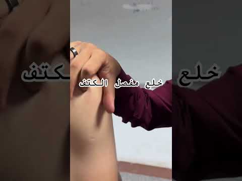 خلع مفصل الكتف دكتور محمد علاء