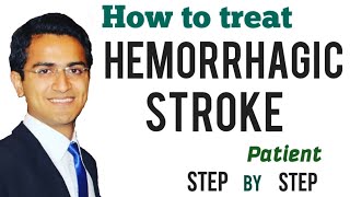 Hemorrhagic Stroke (Intracerebral Hemorrhage) Emergency Treatment Management Medicine Lecture USMLE