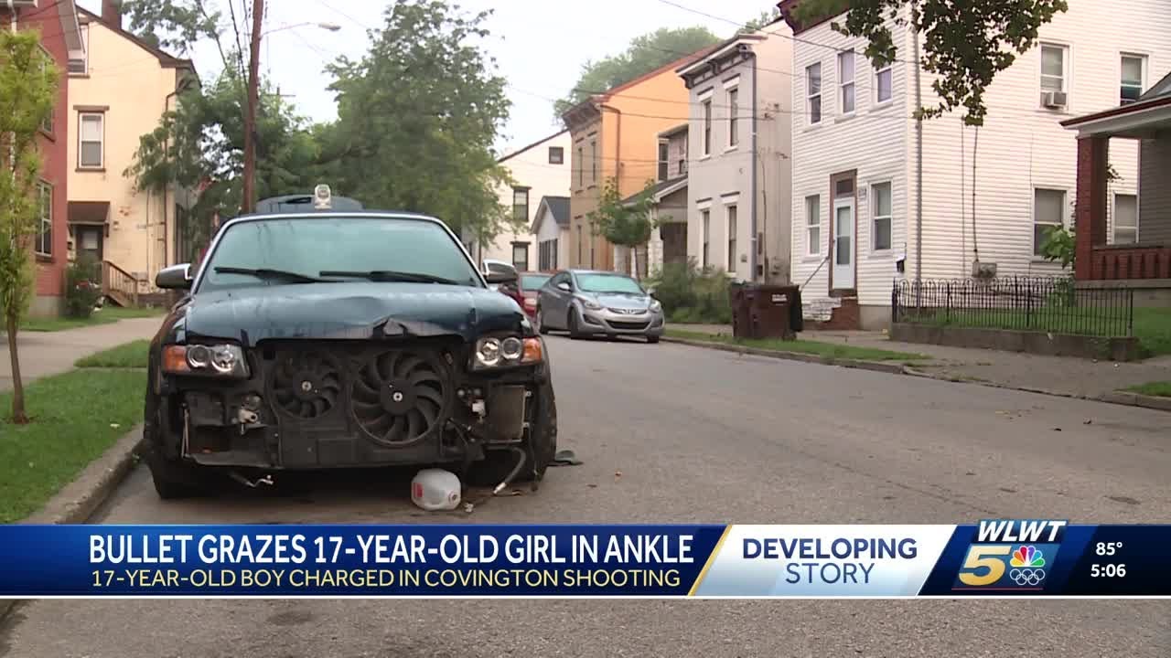 Police: 17-year-old hospitalized after being grazed by bullet in leg ...