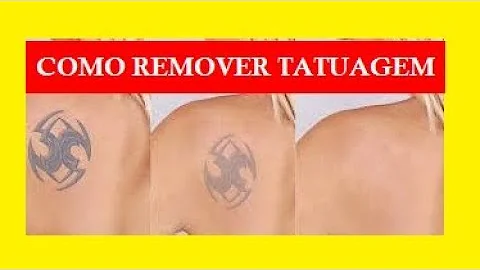 Como apagar uma tatuagem Recém-feita?