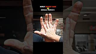 Normal guy won Biggest hand in the world 🔥🥶 Popeye vs Normal People's #armwrestling