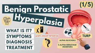 What is Benign Prostatic Hyperplasia? | Overview for Med Students | Urology