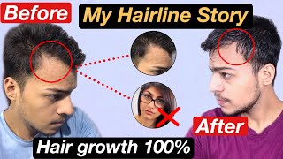 My Hairfall True Story  Mne Apne Baalo Ko Ese Regrow Kiya 100% Solution | Stop Hairloss, Hairline
