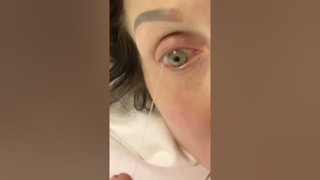 Eye mucous string all the way around my eye! Wow YouTube