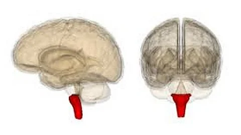 Simple Concussion Grading System - Dr Robert Arnone