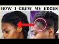 REGROW YOUR  EDGES AND BALDSPOTS - The Natural Way