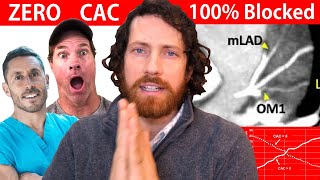 The Zero Coronary Calcium Con (When CAC = BS) by Mic the Vegan 18,843 views 4 months ago 16 minutes