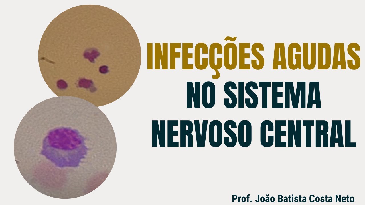 Infecções Agudas do Sistema Nervoso Central