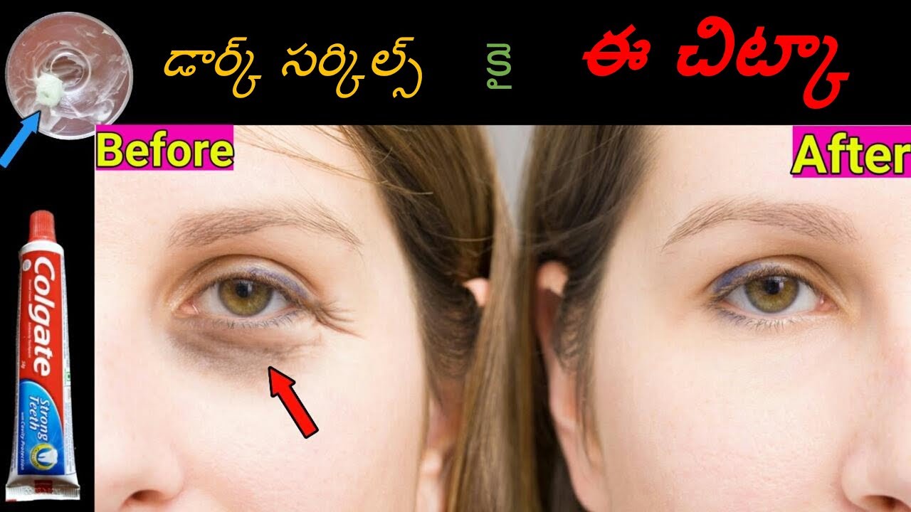 Home Remedies to remove eye Dark Circles Beautytip4youTelugu YouTube
