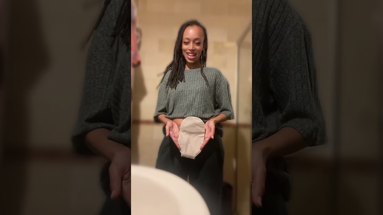 Смена мешка для стомы с изюминкой. #мешокдлястомы