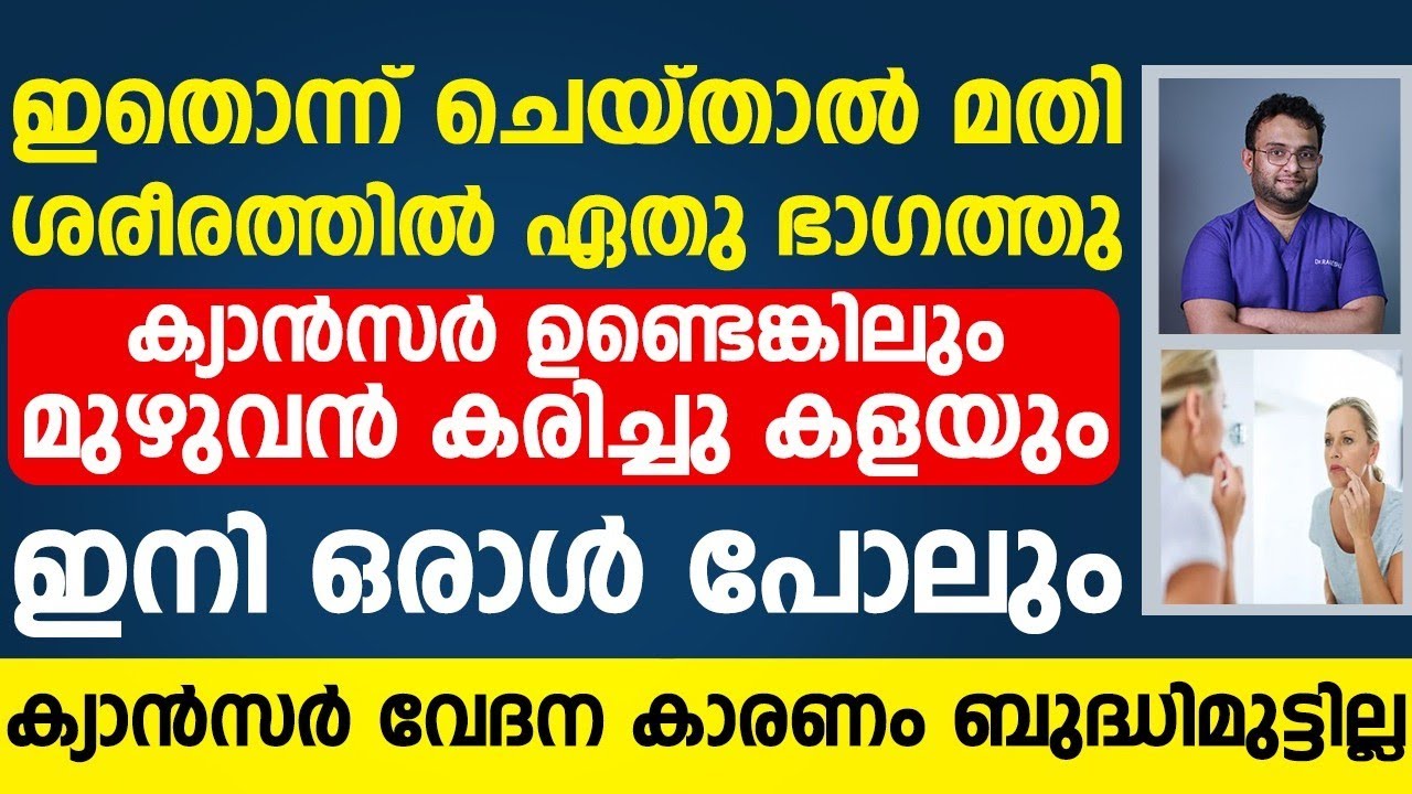 ഇത് ചെയ്താൽ ശരീരത്തിന്റെ എതുഭാഗത്തെയും ക്യാൻസർ കോശങ്ങളെ നശിപ്പിച്ച് വേദന ഇല്ലാതാകും|cancer Malayalam