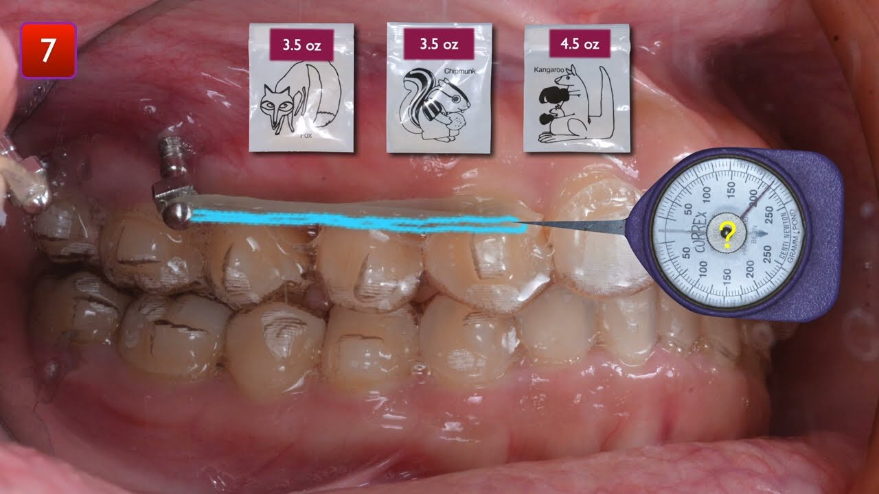 Elastics Research｜【Chris Chang Ortho】CC606