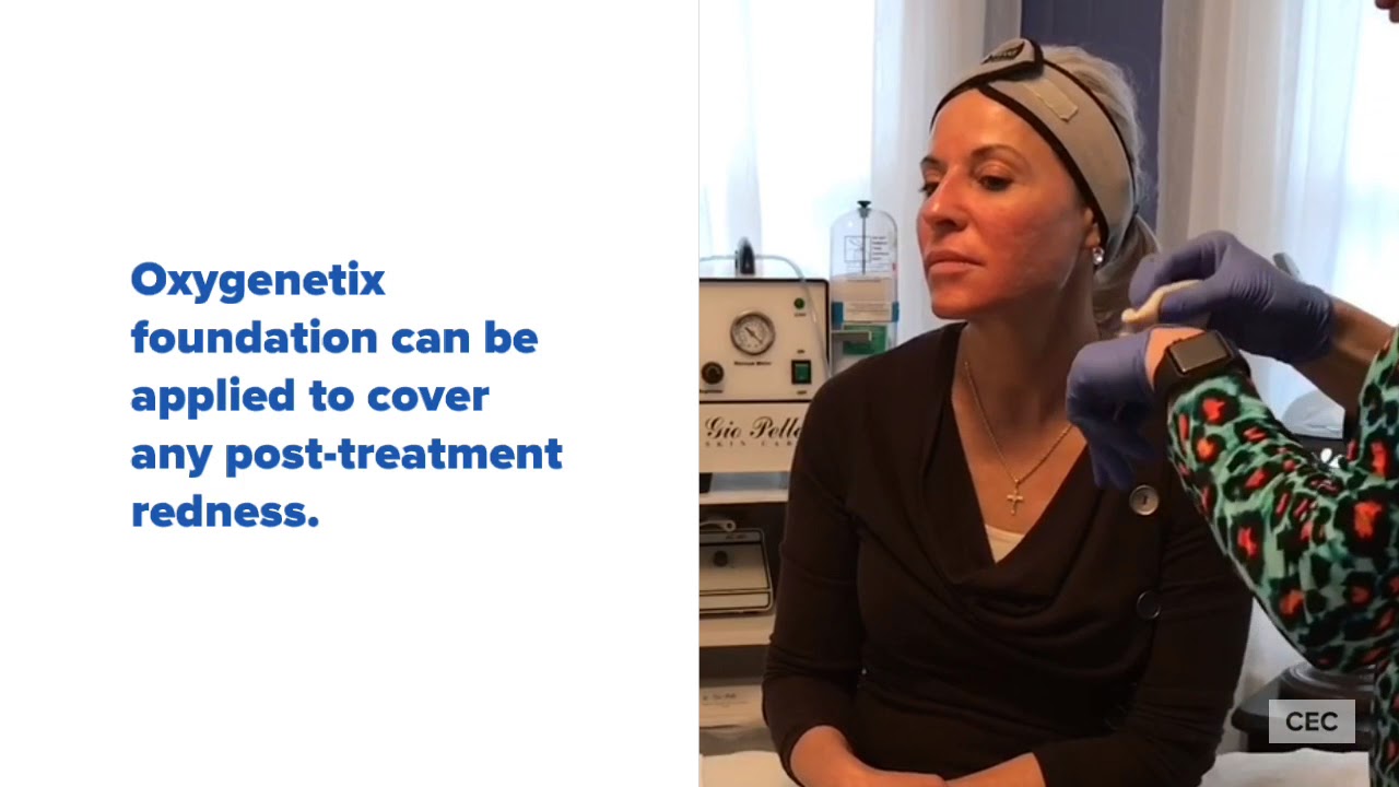 eMatrix Treatment at the Cosmetic Enhancement Center of New England