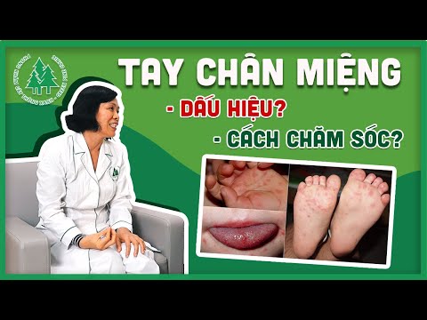 Bệnh chân tay miệng ở trẻ nhỏ - Dấu hiệu và Cách chăm sóc - Phòng khám Cây Thông Xanh