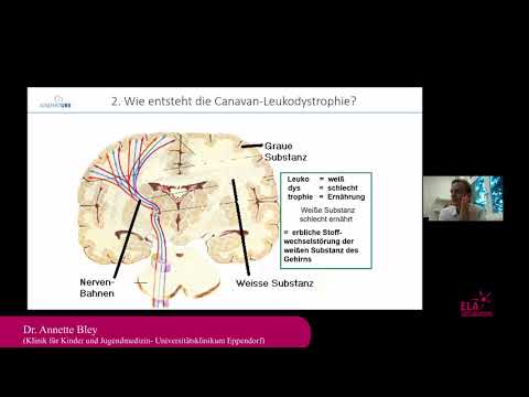 ELA Webinar Morbus Canavan