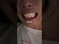 day21