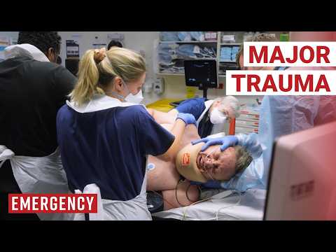 Shocking High Speed Crashes Patients Somehow Survived | Emergency