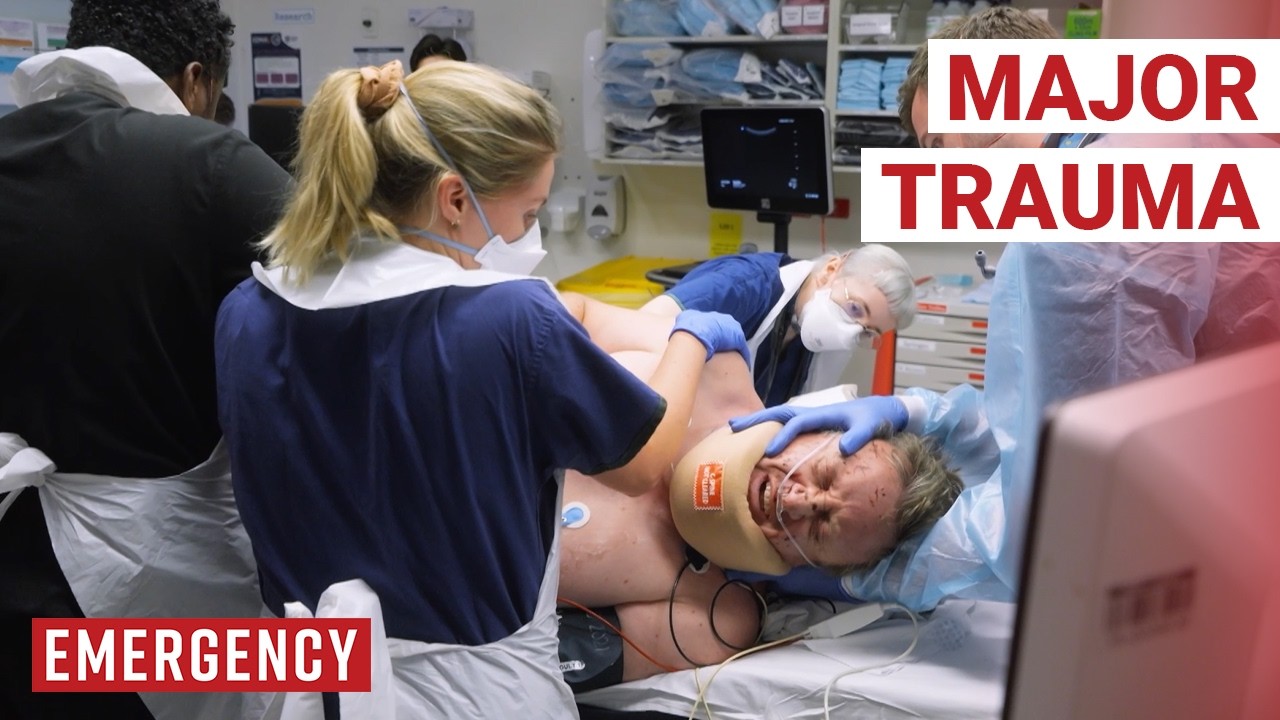 Shocking High Speed Crashes Patients Somehow Survived |… — Transcript