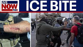 Protester bites 2 ICE agents in Newark,  DOJ files charges