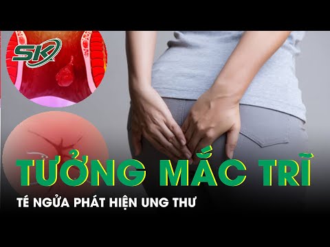 Video: Về các dấu hiệu sinh sản trong cá Oscar