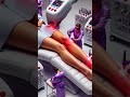 Процедура лазерной эпиляции