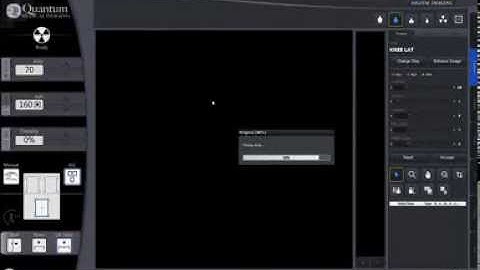 DRive V06 2 View Knee Workflow Integrated