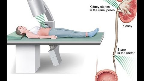 Renal endoscopy CPT code - simplify medical coding