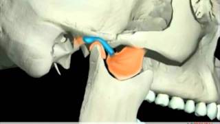 TMJ Disorders