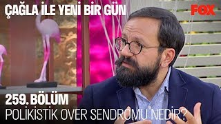 Polikistik Over sendromu nedir? Çağla ile Yeni Bir Gün 259. Bölüm