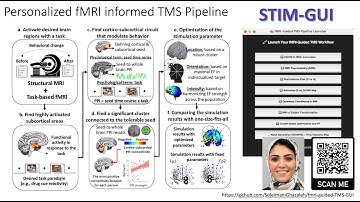 Neuroimaging informed Brain Stimulation: Target, Dose, Timing and Context