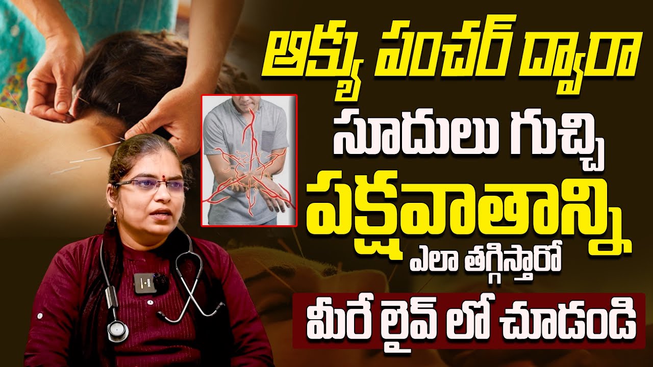 Acupuncture Treatment For acupuncture-treatment-for