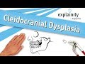 Understanding Cleidocranial Dysplasia