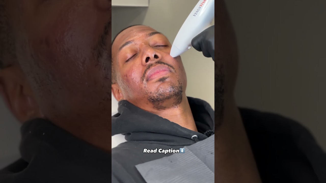 Fast Acne Treatment! Results in less than 30 days