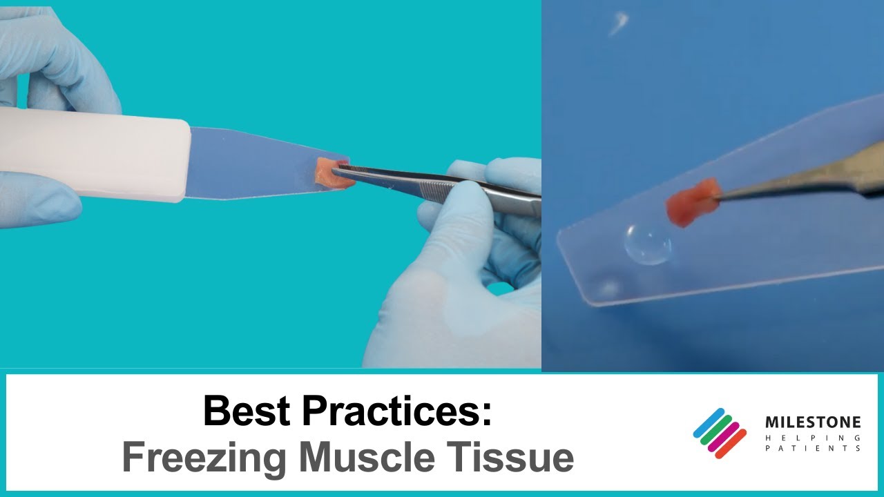 PrestoCHILL Best Practices: How to Freeze Muscle Tissues