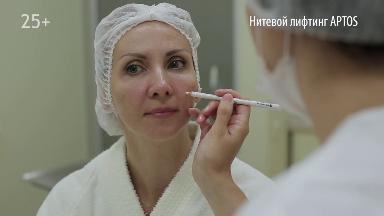 Нитевой лифтинг APTOS в GMTClinic