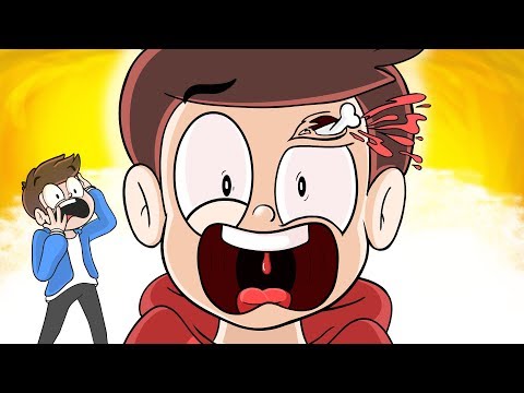 O DIA QUE EU FIZ O PIOR MACHUCADO DA MINHA VIDA